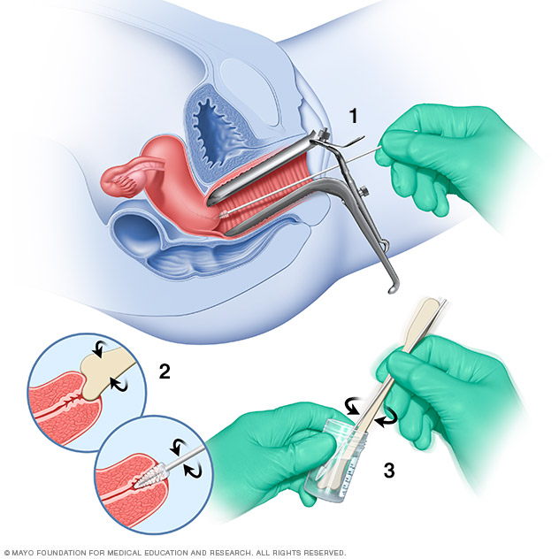 What do Pap smears test for?